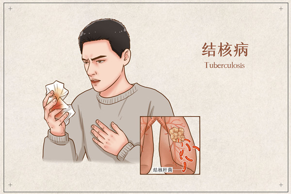 肺结核有哪些症状，怎么治好