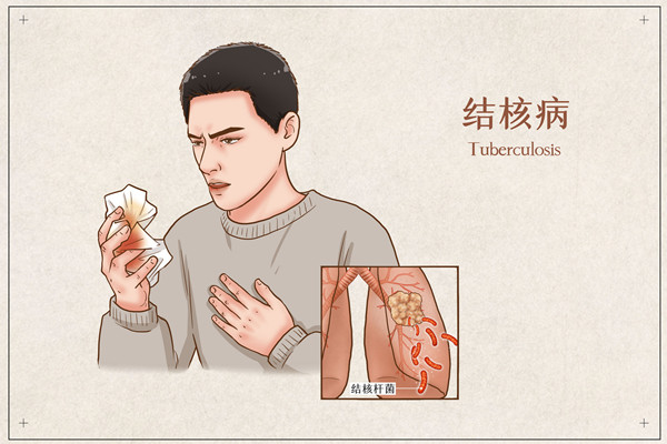 怎么治肺结核