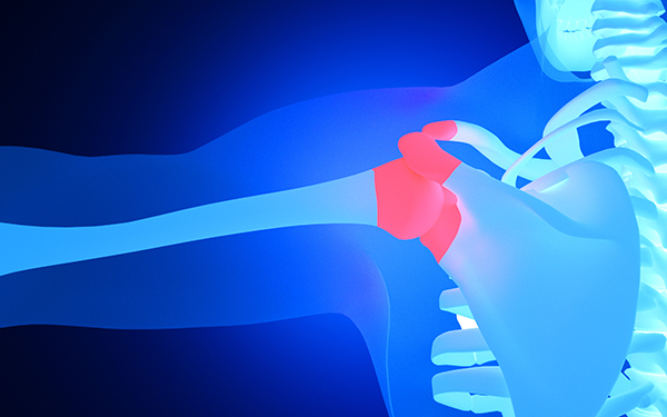 骨结核复发怎么治疗 骨结核复发怎么治疗