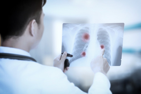 肺结核有哪些症状，怎么治