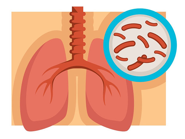 肺结核怎么治疗 肺结核怎么治疗